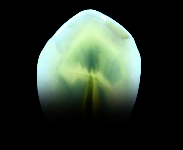 Formation GRF - GROUPE RAPHAËL FORMATION - Dentisterie esthétique